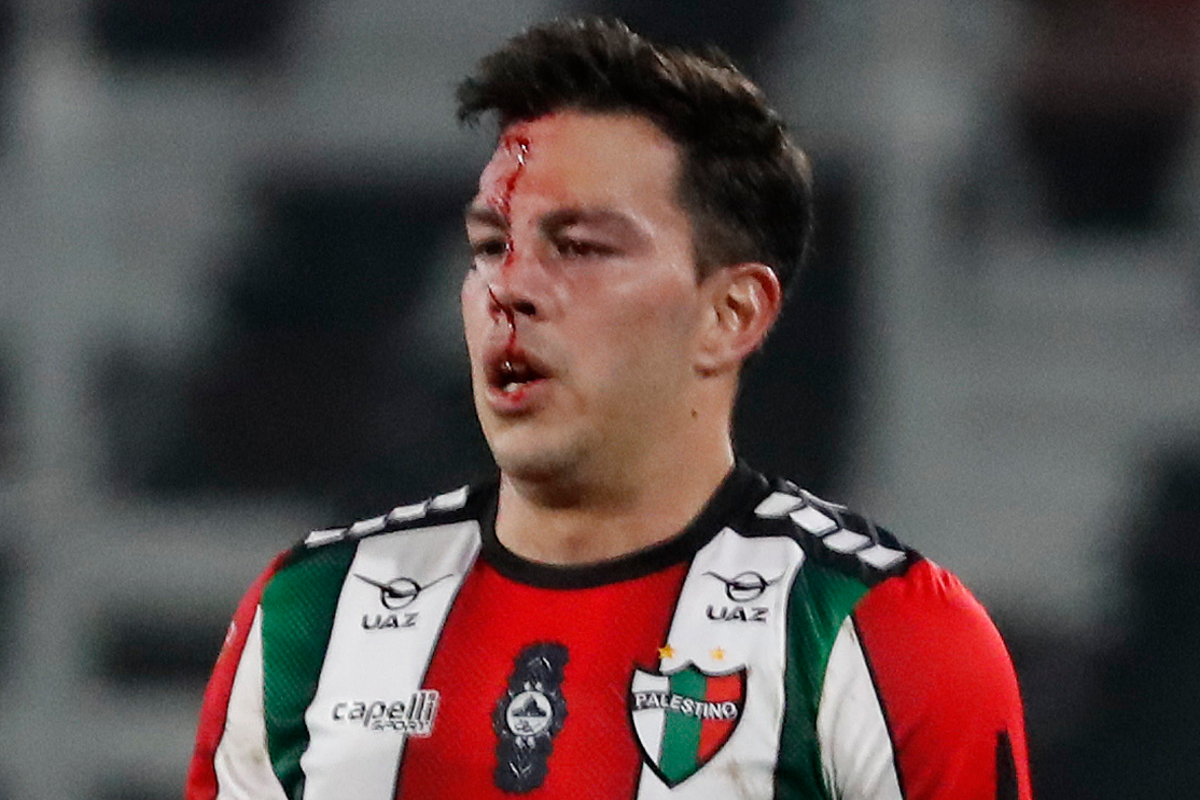 Fernando Meza sangra en su rostro tras recibir un patadón de Jeyson Rojas en el triunfo 1-0 de Colo-Colo sobre Palestino por la Copa Chile 2023.